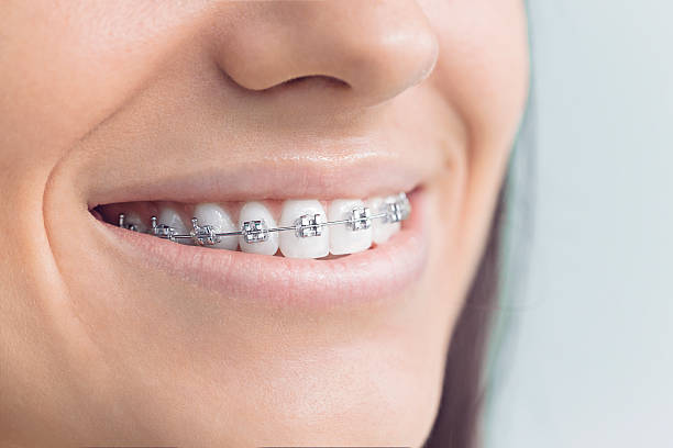 Best Dentures (Full and Partial)  in Monon, IN